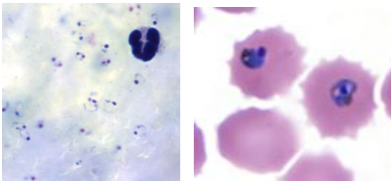 <p>Identifique e cite uma forma diagnóstica</p>