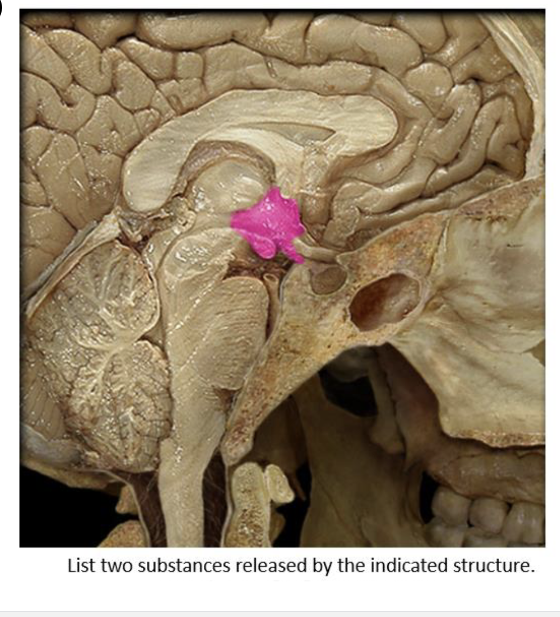 term image