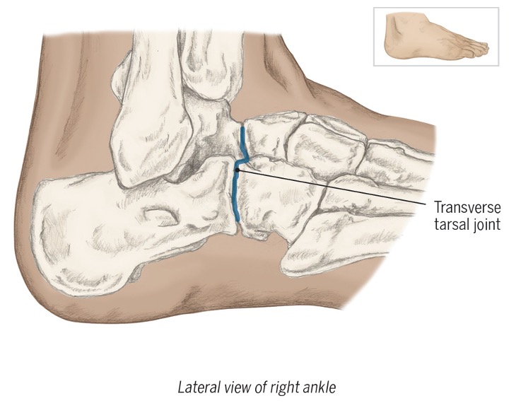 <p>transverse tarsal joint also help with inversion and eversion (don’t worry abt) </p>