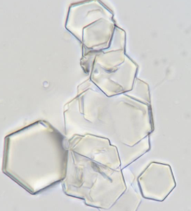 <p>Cystine Crystals</p>