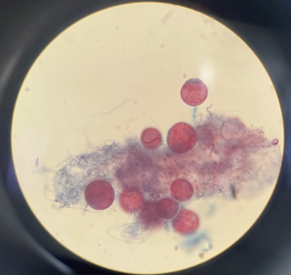 <p>Vorticella</p>