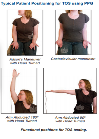 <p>perform WBI 1st</p><p>PPG sensors are placed on digits to evaluate waveforms during different maneuvers such as : </p><p>sitting still &amp; turning head</p><p>moving hands slightly backwards on lap (costoclavicular)</p><p>abducting arm 90 &amp; 180 degrees</p><p>&amp; whatever position the patient feels symptomatic in</p>