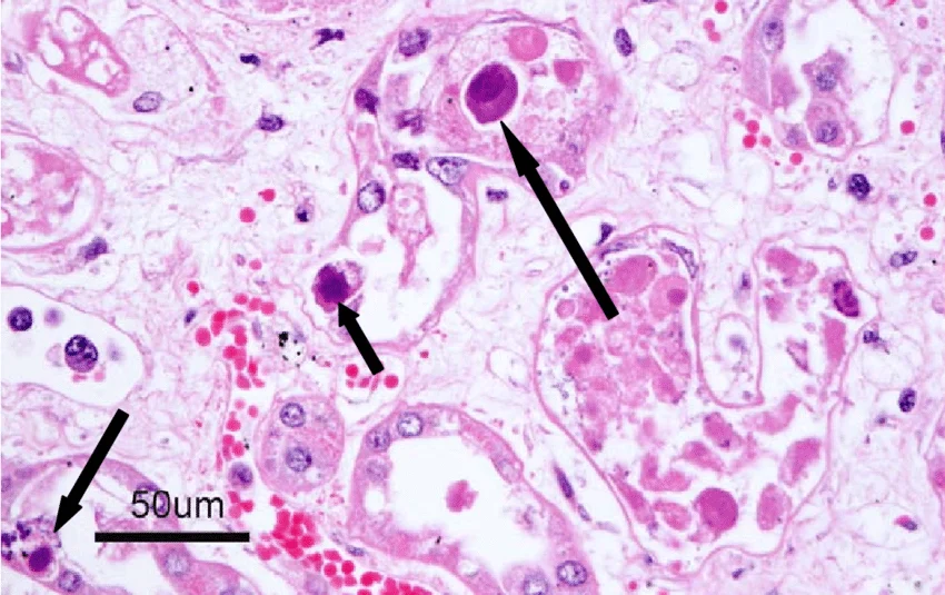 <ul><li><p><strong>visible changes</strong> to cells following virus infection</p><ul><li><p>cells round up and detach from flask</p></li><li><p>holes appear in cell layer</p></li></ul></li><li><p><strong>syncytia</strong> formation: cells start to fuse creating very large cells with several nuclei and eventually cell death</p></li><li><p>inclusion bodies (masses of viral proteins within hte cell)</p></li></ul><p></p>