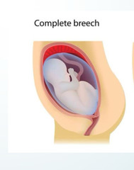 <p>Butt first with both legs down</p>