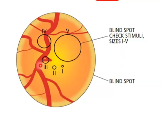 <p>goldman size 3 </p><p>4mm²</p><p>0.15 deg²</p>