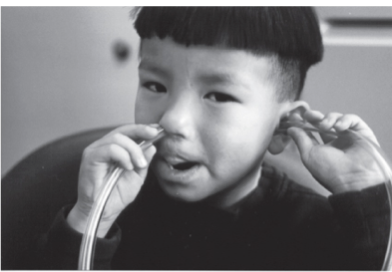 <p>Low-tech therapy tools: listening tube (larger diameter is better) </p>