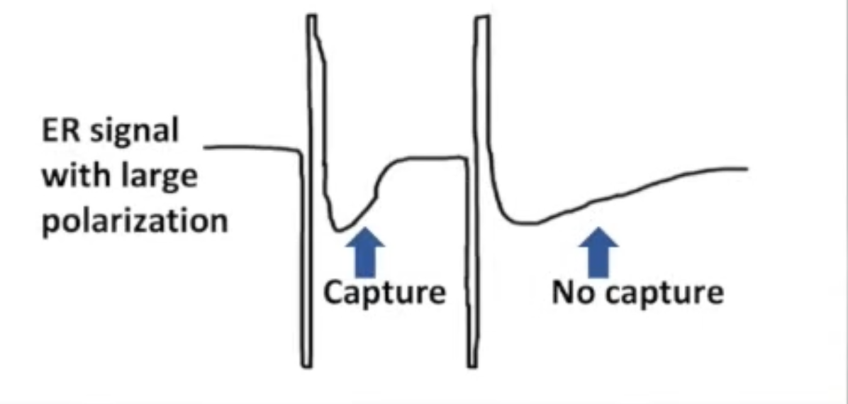 <p>Residual charge (concentration of ions) that remains near electrode after pacing pulse</p><ul><li><p>Consistent with or without capture</p></li><li><p>Autocapture will not function if polarization dominates ER<br>morphology</p></li><li><p>Must be minimized</p></li></ul><p></p>