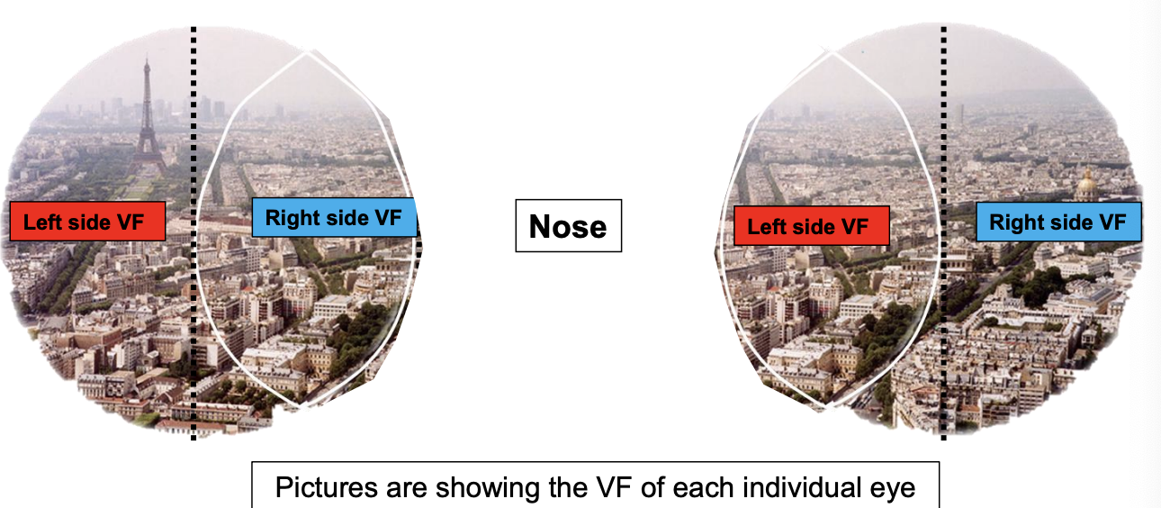 <ul><li><p>individually, each eye has a right VF and a left vf </p></li></ul><p></p>
