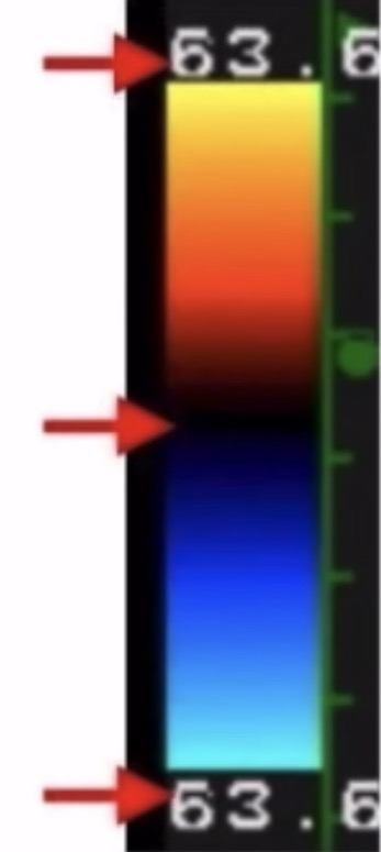 <p><span><span>Looking at this color bar, how would a color Doppler system show blood flow that is accelerating?</span></span></p>