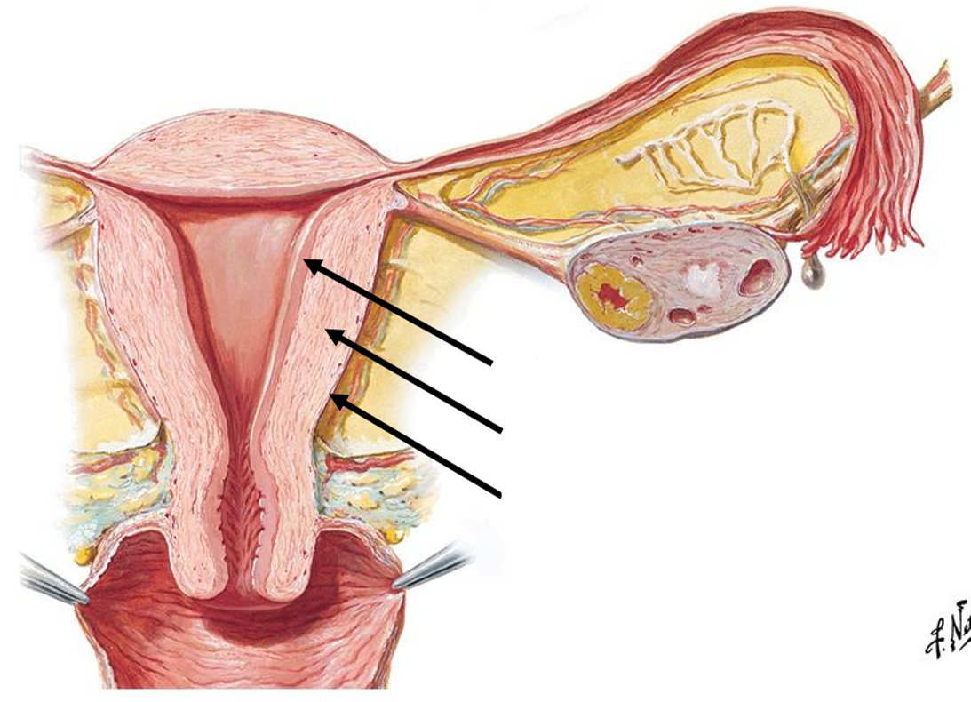 <p>Label the following diagram of the <strong>uterine wall layers</strong></p>