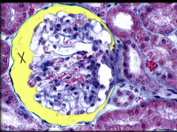 <p><span>Identify the structure highlighted yellow and marked with an X in the image below</span></p>
