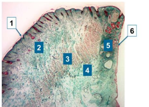 <p>identify the 6 tissue layers of microscopic structure of lower eyeld </p>