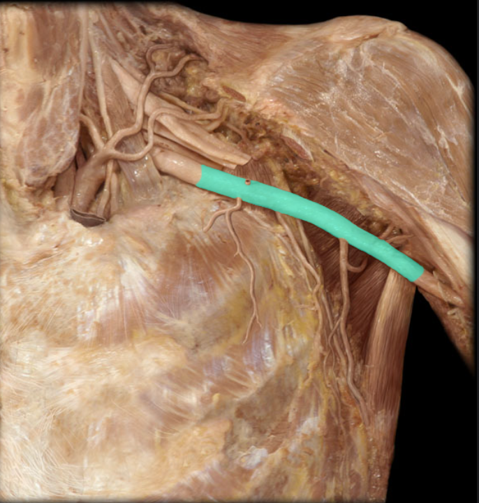 <ul><li><p><strong>Origin: </strong>Subclavian (at lateral border of rib 1)</p></li><li><p><strong>Course:</strong></p><ul><li><p>Passes through axilla surrounded by cords and branches of brachial plexus</p></li><li><p>Divided into 3 parts by pectoralis minor m. First part is proximal to pectoralis minor m., second part is posterior to muscle, and third part is distal to muscle</p></li></ul></li><li><p><strong>Distribution:</strong></p><ul><li><p>Pectoral, shoulder, and scapular regions</p></li><li><p>Superior and lateral aspects of thoracic wall</p></li></ul></li><li><p><strong>Branches:</strong></p><ul><li><p>Superior thoracic (from first part of axillary a.)</p></li><li><p>Lateral thoracic (from second part of axillary a.)</p></li><li><p>Thoraco-acromial (from second part of axillary a.)</p></li><li><p>Subscapular (from third part of axillary a.)</p></li><li><p>Anterior and posterior circumflex humeral (from third part of axillary a.)</p></li><li><p>Continues as brachial artery (at inferior border of teres major m.)</p></li></ul></li></ul><p></p>