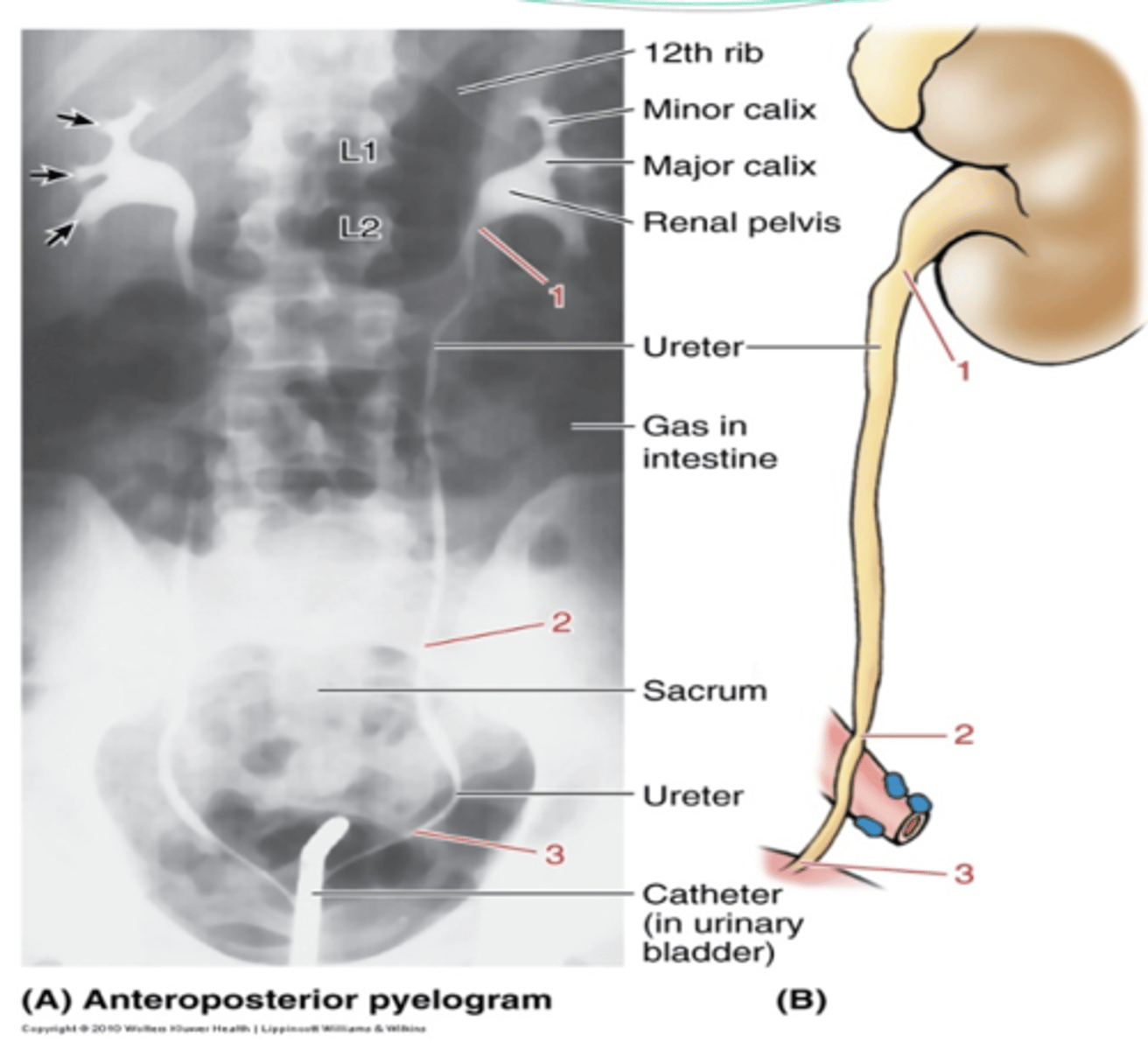 <p>what are the three constrictions of the ureters?</p>