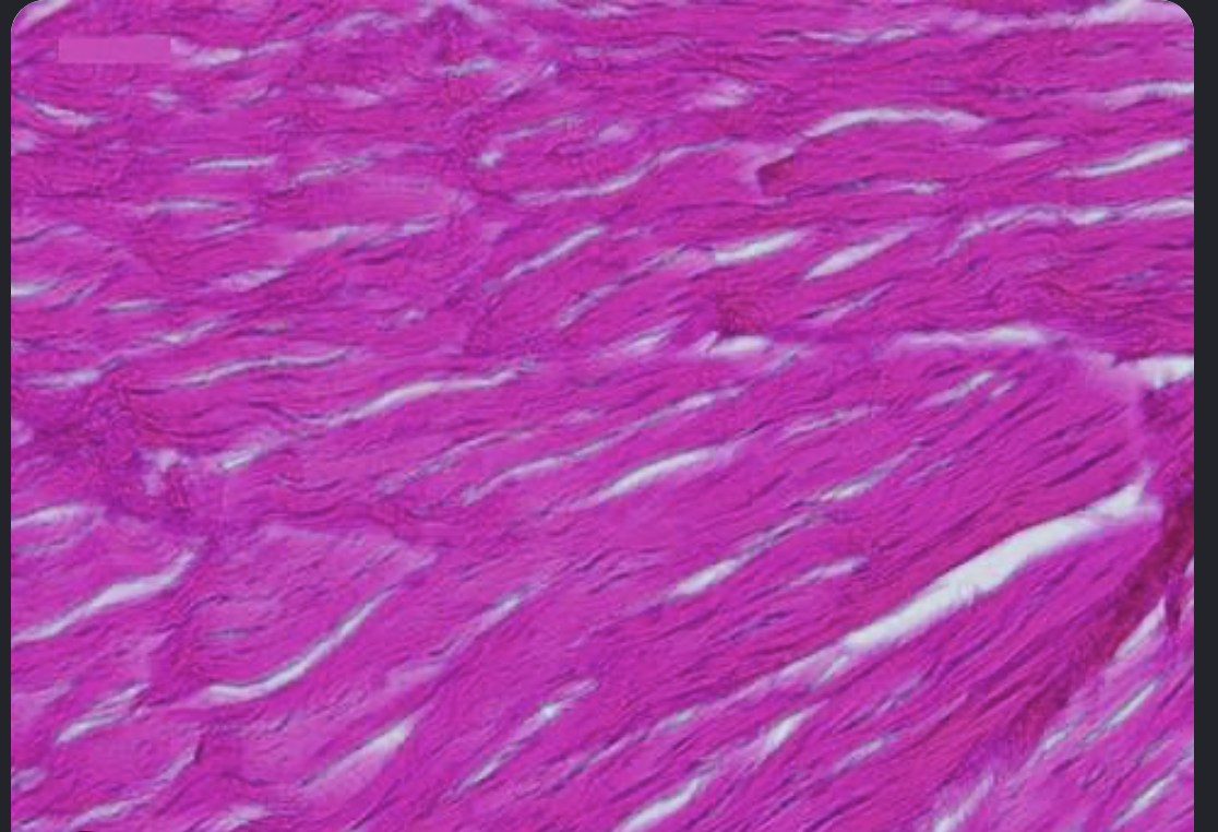 <p>which type of fiber is this</p>