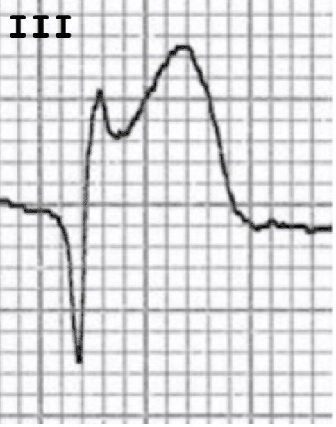 <p>What is this?</p>