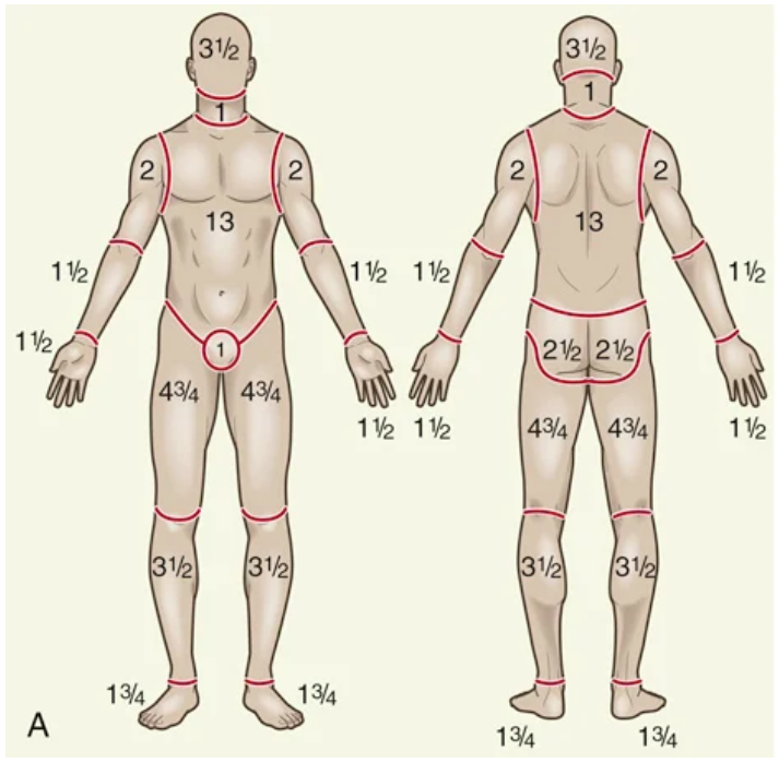 <p>Best used for kids because it considers patient age in proportion to relative body-area size</p>