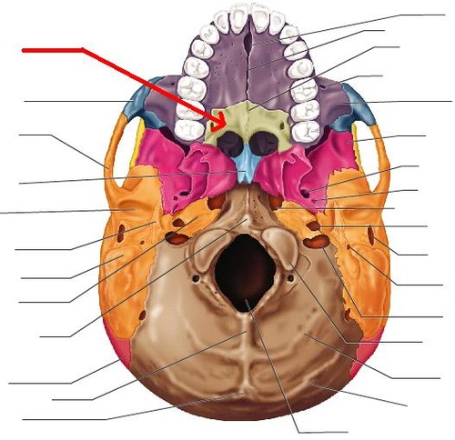 term image