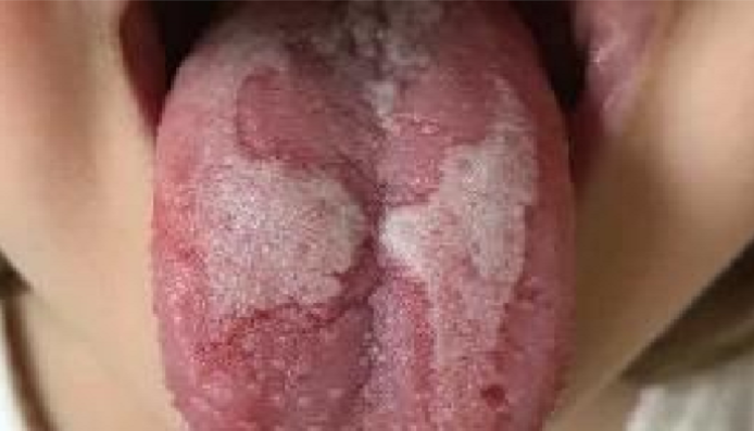 <p>Describe this lesion</p>