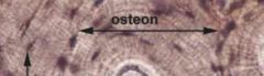 <p>space; tissue type (arrow on left)</p>