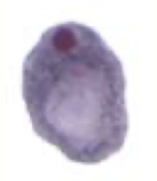 <p>What Amebae is this? Is this the trophozoite or cyst form?</p>