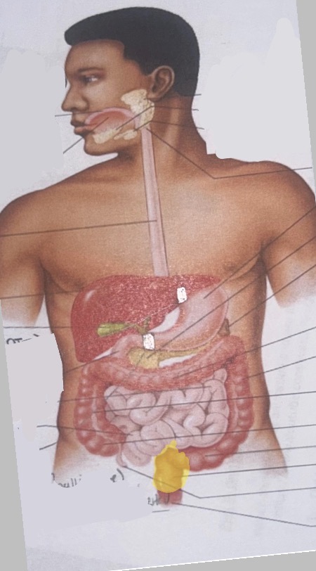 term image