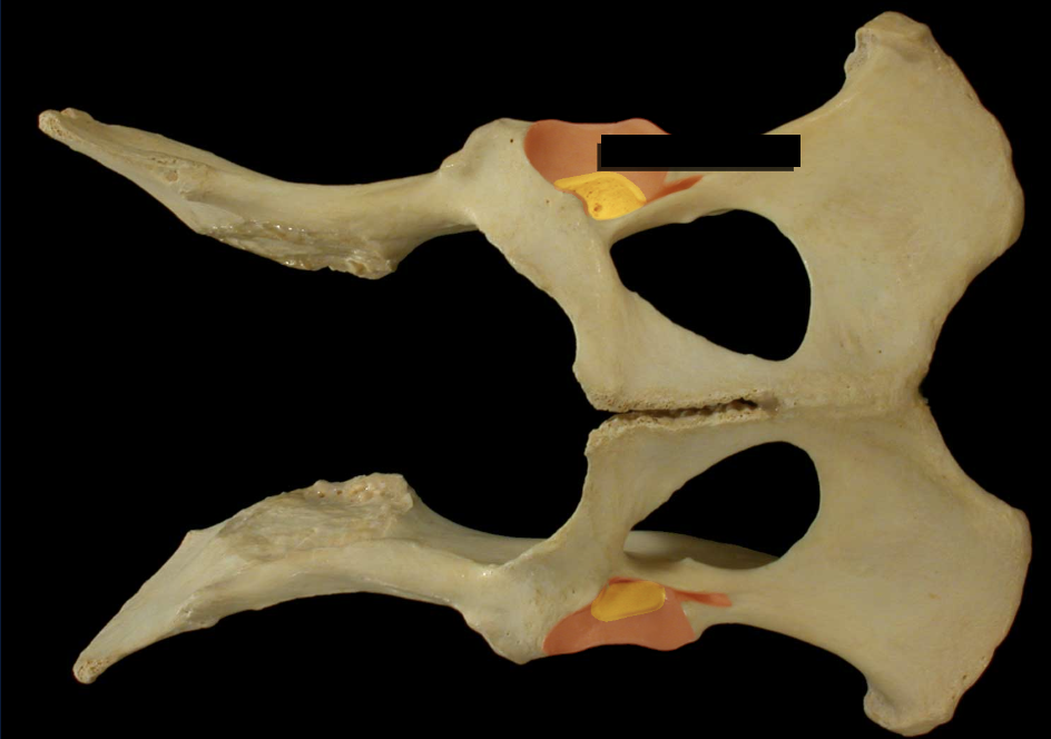 <p>Acetabular notch & fossa</p>