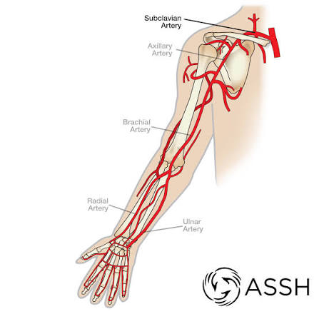 <p>upper part of the arm</p>