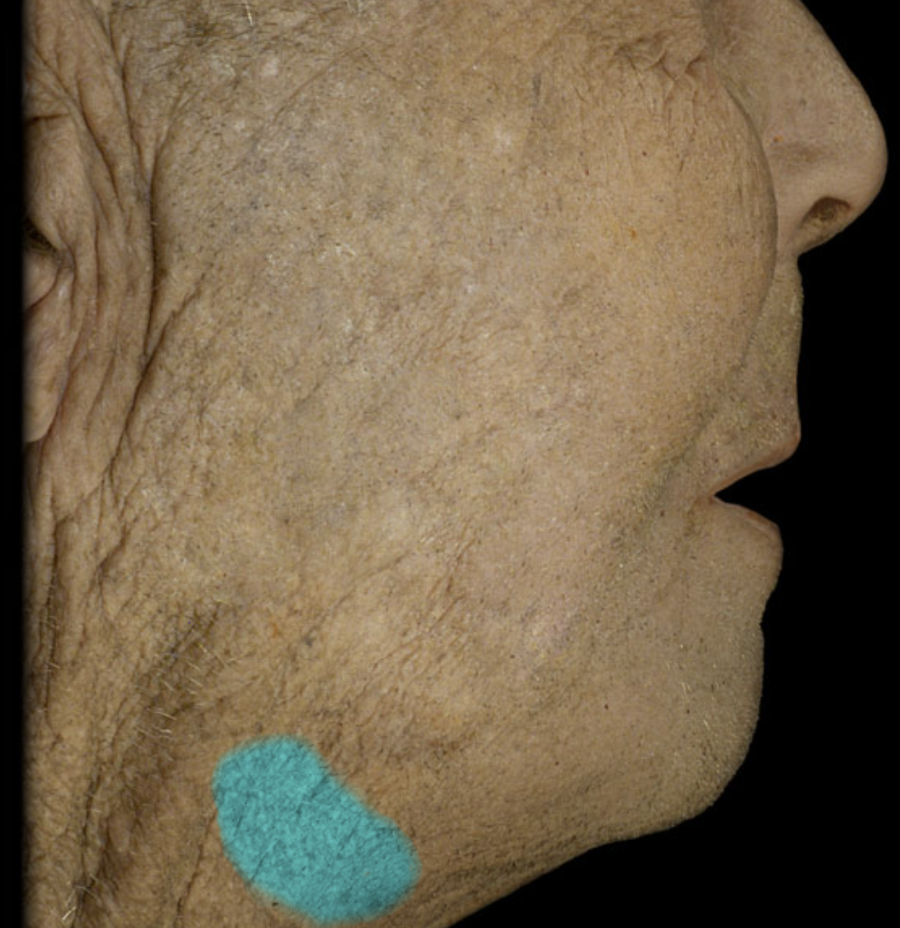 term image