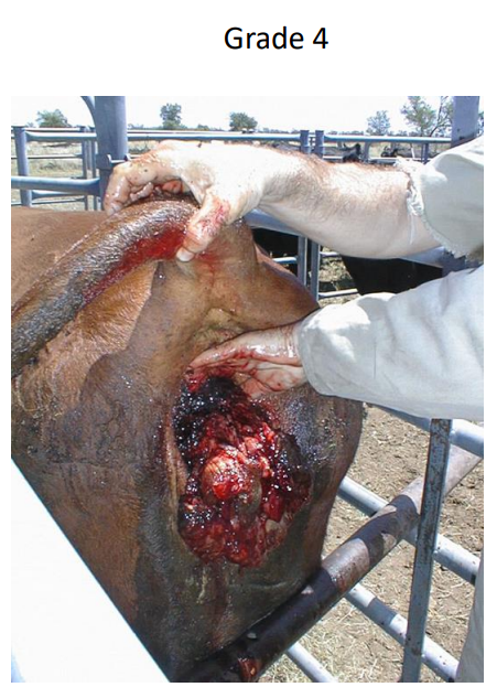 <ol><li><p>Intermittent only when cow lying down, vaginal tissue fine</p></li><li><p>Continuous prolapse, urinary bladder might be trapped</p></li><li><p>Continuous prolapse, urinary bladder trapped, tissue starts to be compromised</p></li><li><p>As above but includes cervix, tissue infected, necrotic and sepsis/peritonitis possible</p></li></ol><p></p><p>*rapid progression through grades</p>