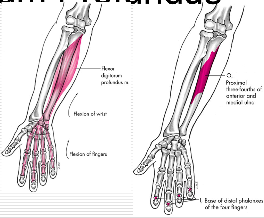 <p>Flexion of fingers 2-5 </p><p>Flexion of wrist </p><p>O - Medial aspect of coronoid process of ulna, superior ¾ of anterior and medial surfaces of ulna </p><p>I - Palmar aspects of bases of distal phalanges 2-5 </p>
