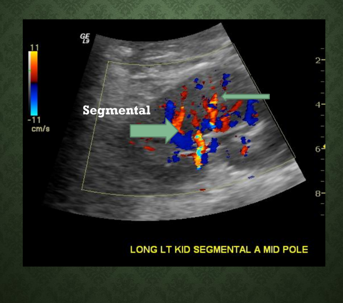 <p>What 2 intrarenal arteries are labeled in this image?</p>