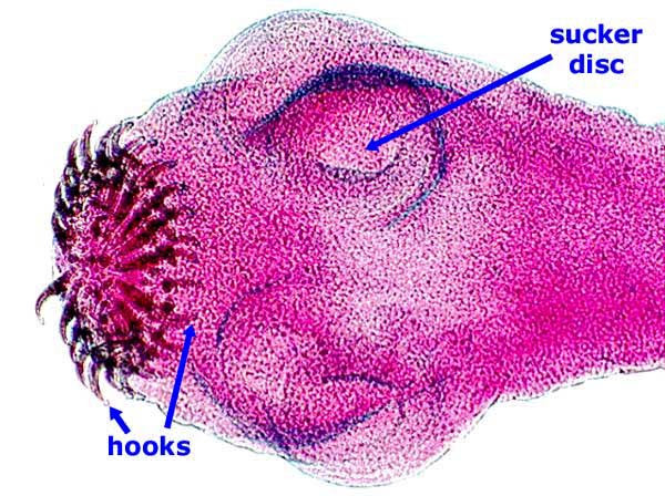 <p><span>How is this flatworm transmitted to humans?</span></p>