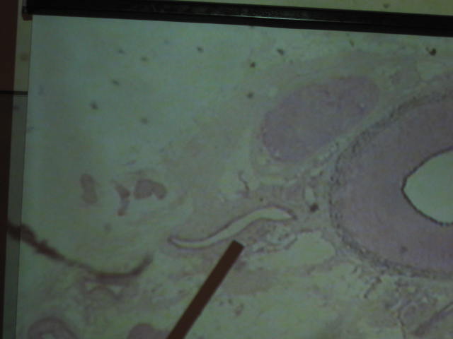 <p>Identify The Vessel</p><p>Lab Image 3-19</p>
