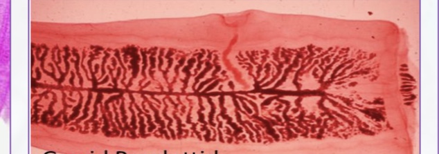 <p>are at the posterior end of the worm. They are filled with eggs and will eventually break off the worm so that embryos can be transferred to the host.</p>
