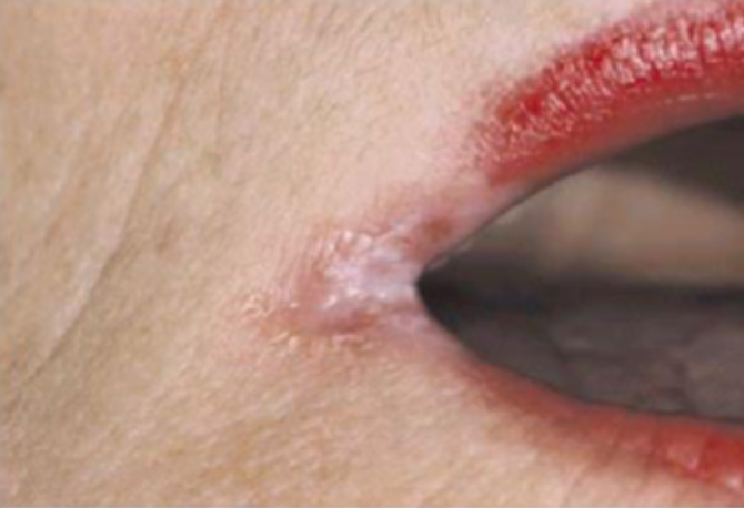 <p>what is this condition</p>