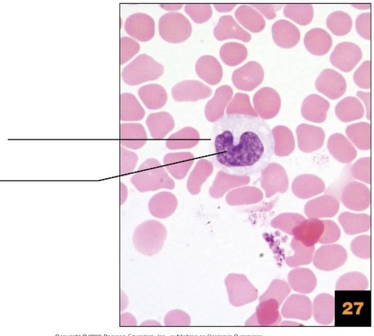 <p>Label the image</p>