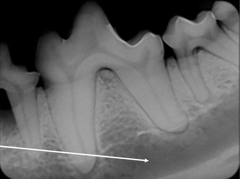 <p>Is this the mandible or the maxilla? How do you know?</p>