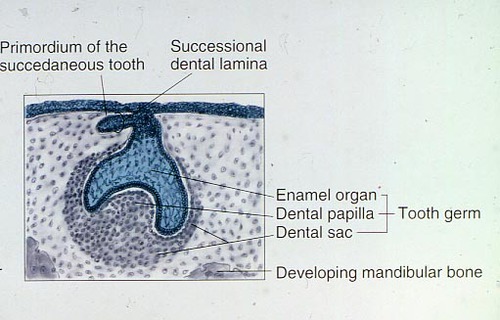 <p>bud of the succedaneous tooth</p>