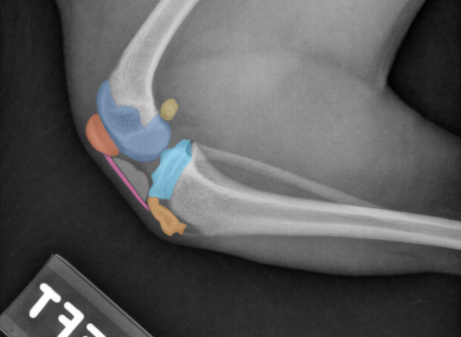 <p>(Ca.) Hindlimb: Describe Structures of the Genus (“Stifle”)</p>