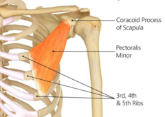 <p>Ribs 3-5</p>