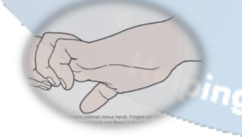 <p>Claw Fingers</p>