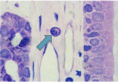 <p>identify the type of cell pointed by arrow</p>