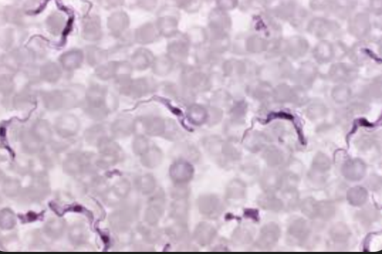 <p><span style="background-color: transparent; font-family: "Times New Roman", serif;">Trypanosoma brucei</span></p>