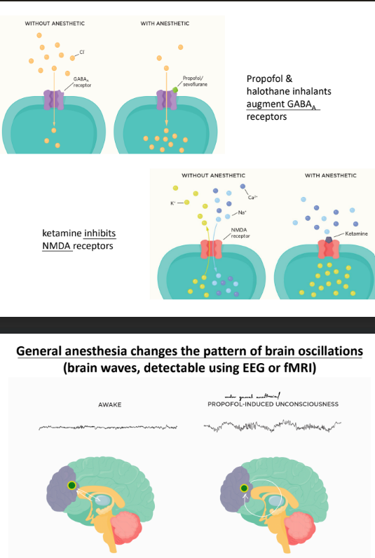 <p>general anesthesia is a drug-induced <strong><u>reversible</u></strong> state defined by 5 endpoints:</p><ul><li><p><u>unconsciousness </u>— lack of awareness of sensory input</p></li><li><p><u>analgesia </u>— lack of pain</p></li><li><p><u>akinesia </u>— lack of movement</p></li><li><p><u>amnesia </u>— lack of recall</p></li><li><p><u>physiological stability</u> — maintaining normal levels of all important physiological functions</p></li></ul><p>_</p><p>propofol <strong>excites/increases<u> </u></strong><u>GABA<sub>A</sub> Rs</u> (so increases Cl- influx)</p><p>ketamine <strong>inhibits </strong><u>NMDARs</u> (so inhibit Ca2+, Na+ influx and K+ influx)</p><p>^^</p><ul><li><p>this shows that general anesthesia will <u>change brain patterns</u> b/c <u>GABA<sub>A</sub> Rs and NMDARs affect excitatory & inhibitory neurons</u></p></li></ul><p></p>