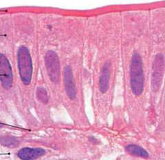 <p>Made up of a single layer of tall cells that fit closely together</p>