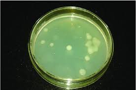 <p>forms <mark>large, raised, and highly </mark><strong><mark>mucoid</mark></strong><mark> (slimy or sticky) colonies</mark>. Because of their abundant polysaccharide capsule, the colonies are typically <strong>greyish-white</strong> in color, glistening, and circular with a smooth, convex or dome-shaped elevation</p>