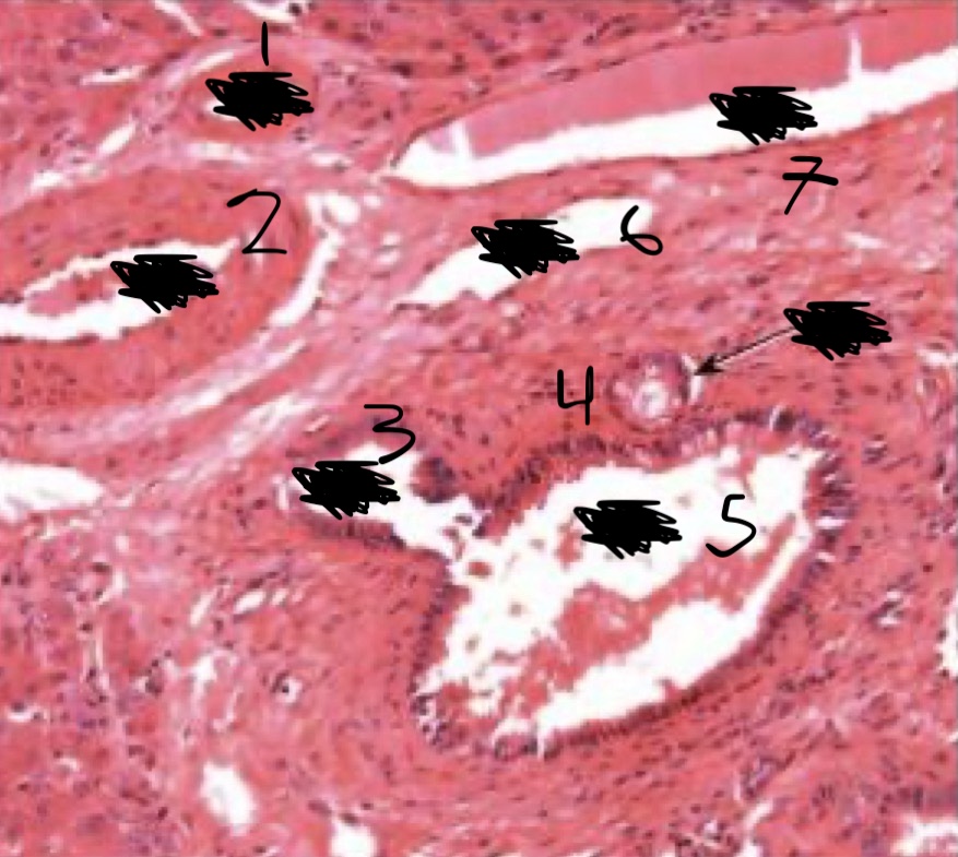 <p>Identify the Organ and Structures?</p>