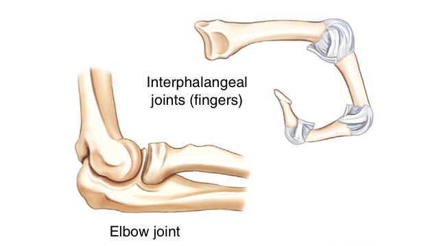 <p>what movement are these joints?</p>
