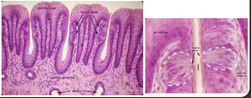 <p>- epithelium</p><p>- taste bud</p><p>- taste pore</p><p>- taste receptor cell</p><p>- lamina propria</p><p>- muscle layer</p>